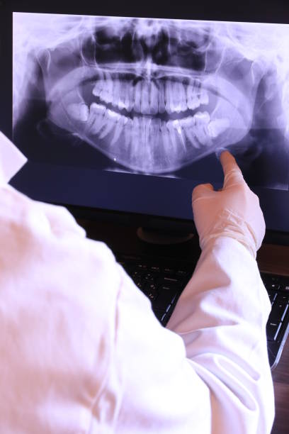 Best Emergency Treatment for Dental Infections or Abscesses in West Covina, CA