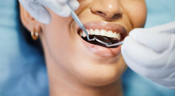 Best Emergency Dental Care for Broken or Chipped Teeth in West Covina, CA
